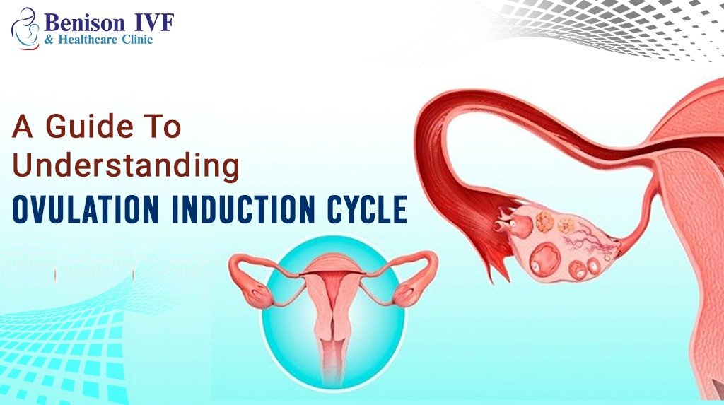 Ovulation Induction