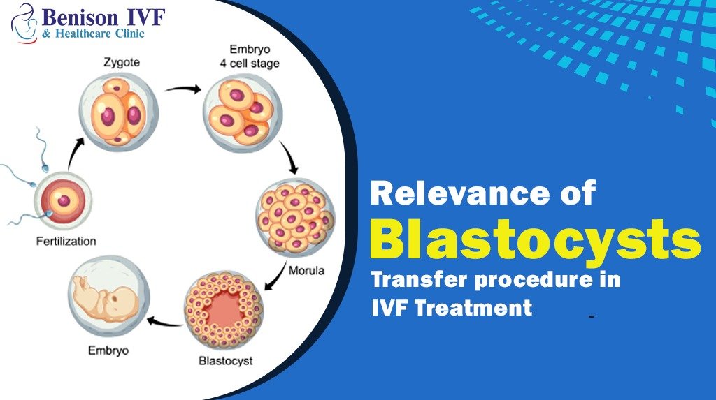 Best IVF Center In Noida